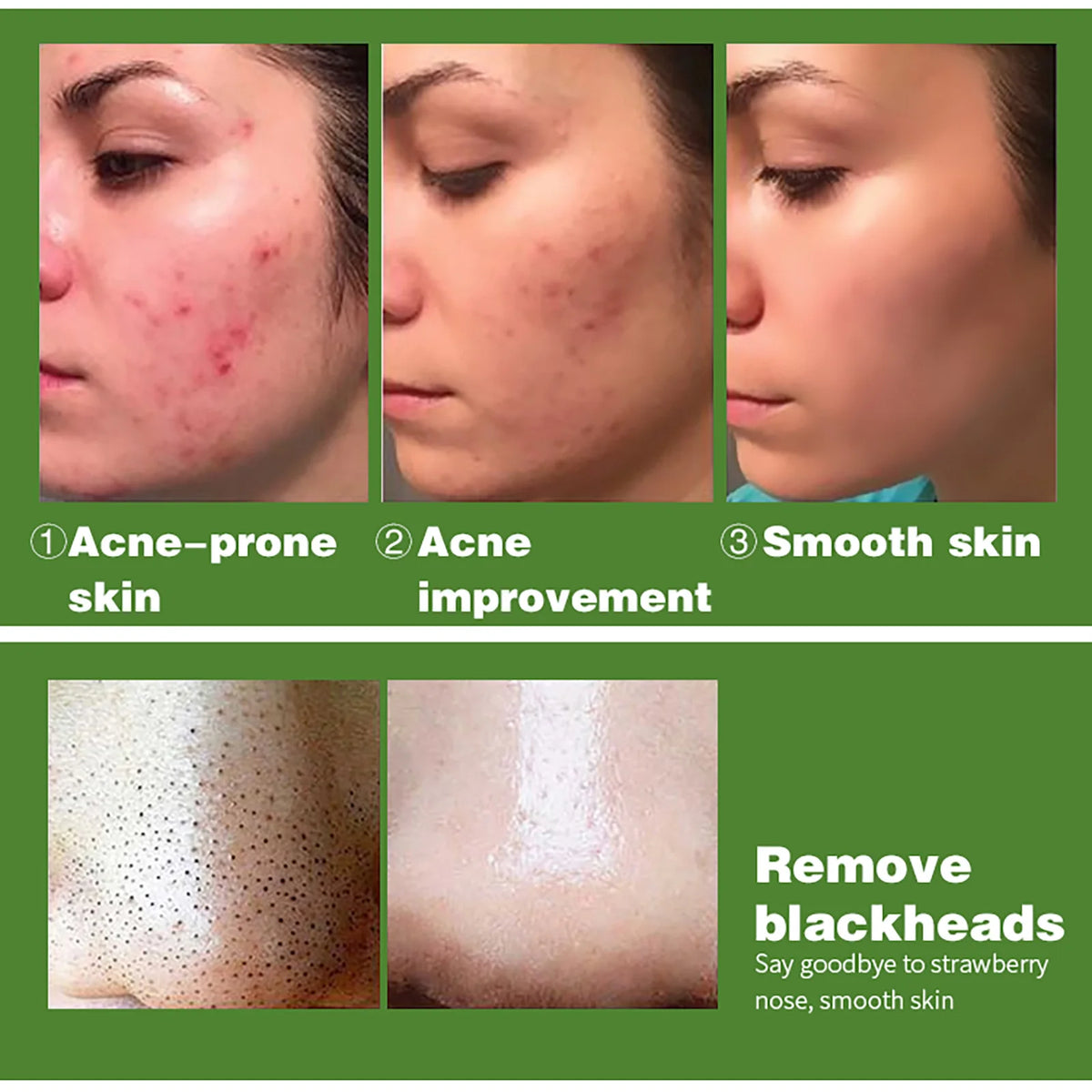 AILKE Organic Turmeric Whitening Skin Care Set, with Vitamin C, Clean Skin, Reduce Acne, Hydrating and Firming for Women