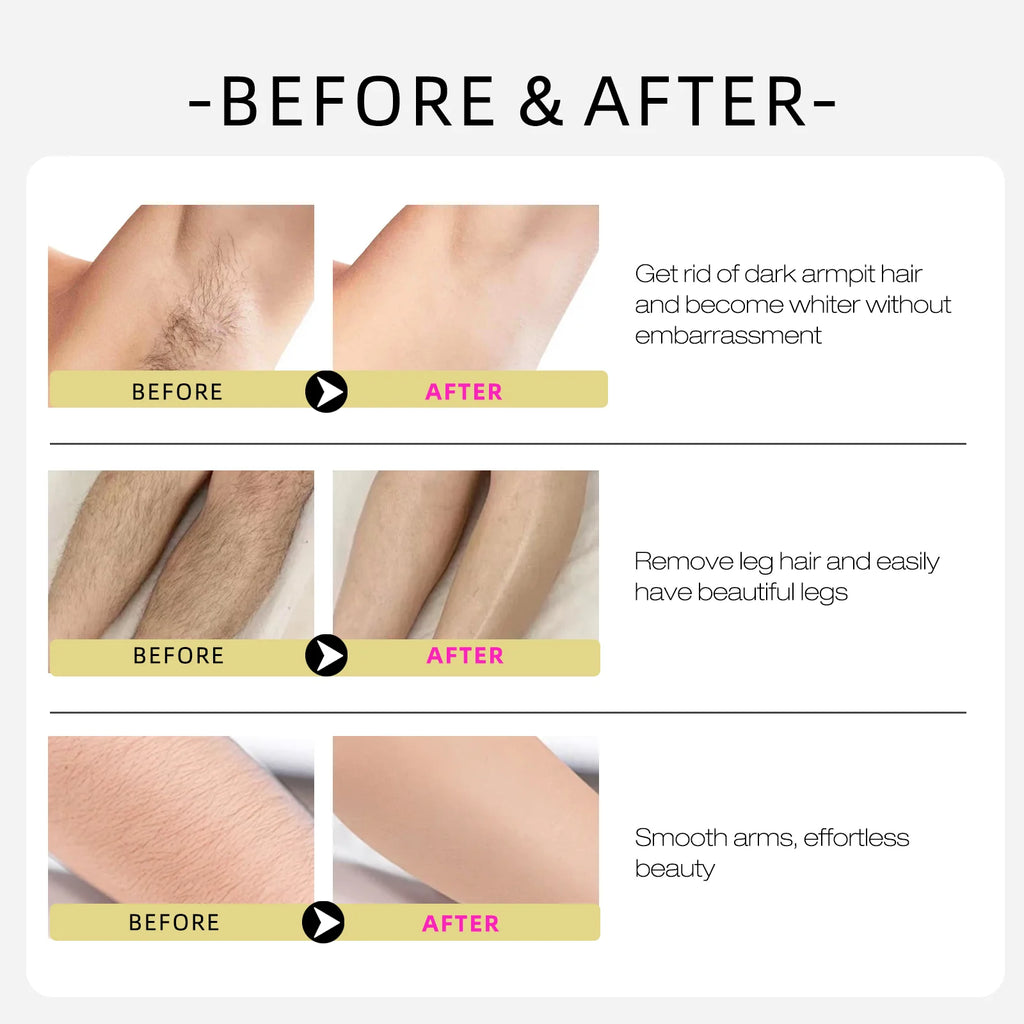 Post-Hair Removal Care Oil – Jojoba and Almond Blend Soothes Sensitivity, Locks in Hydration and Supports Daily Skin Comfort
